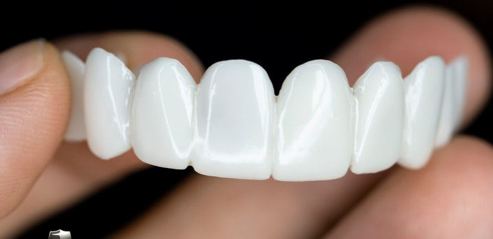 Azura | Snap-On Cosmetic Veneers | Instant Smile Cover for Imperfections