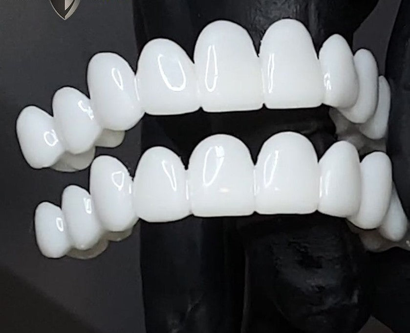 Azura | Snap-On Cosmetic Veneers | Instant Smile Cover for Imperfections